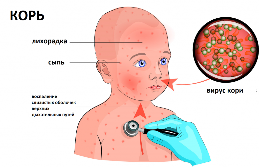 вирус кори.png