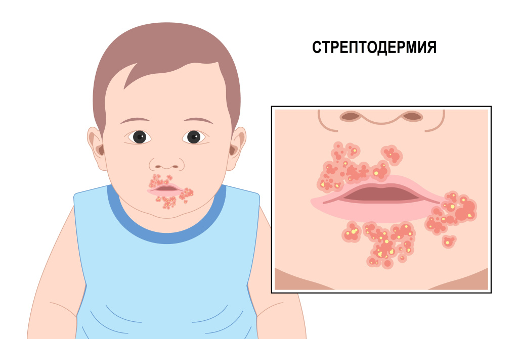 Ребенок1.jpg