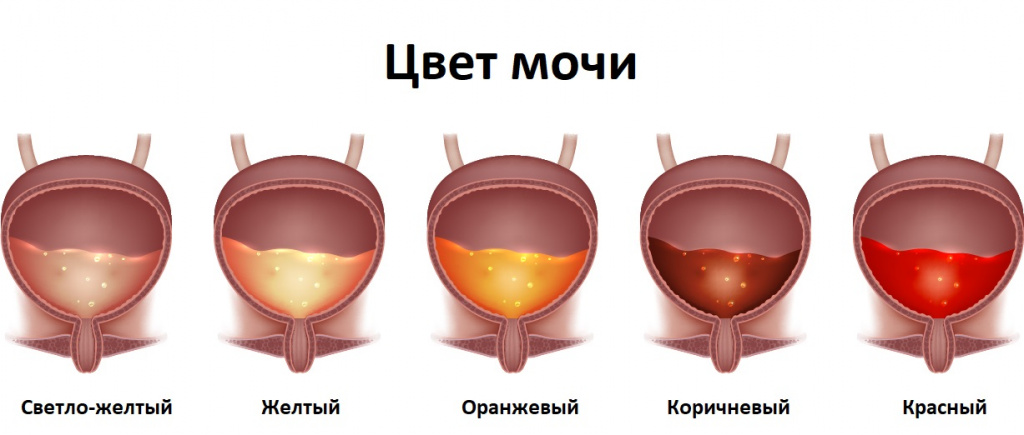 Цвет мочи.jpg