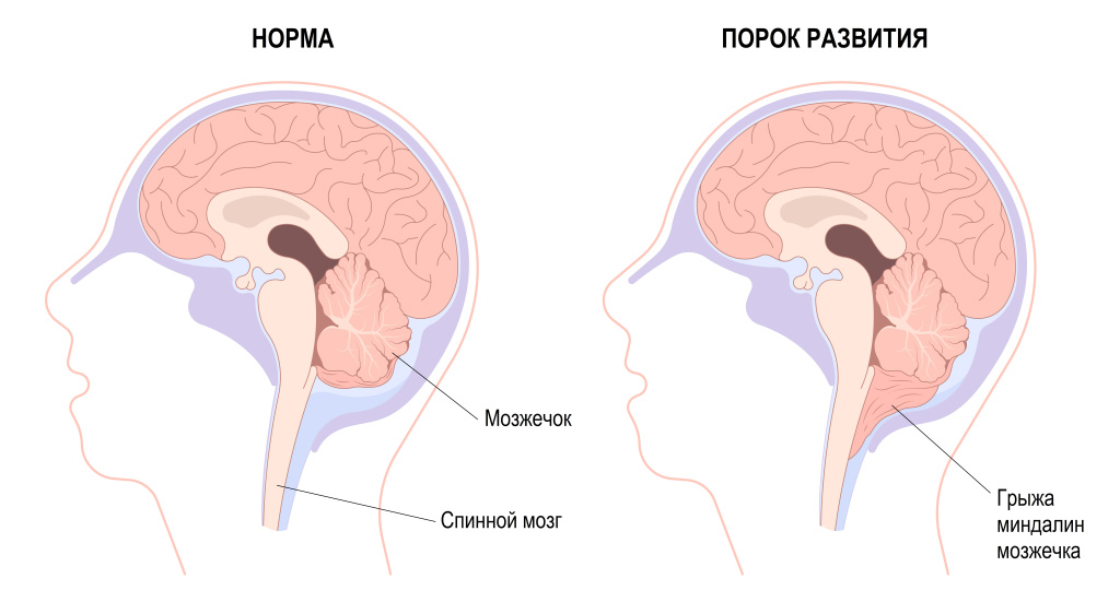 Порок развития.jpg