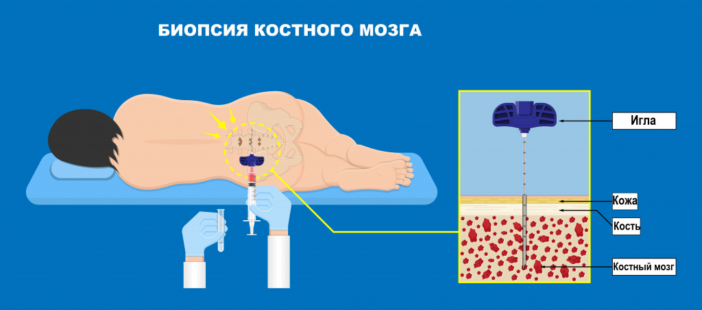 Биопсия.jpg