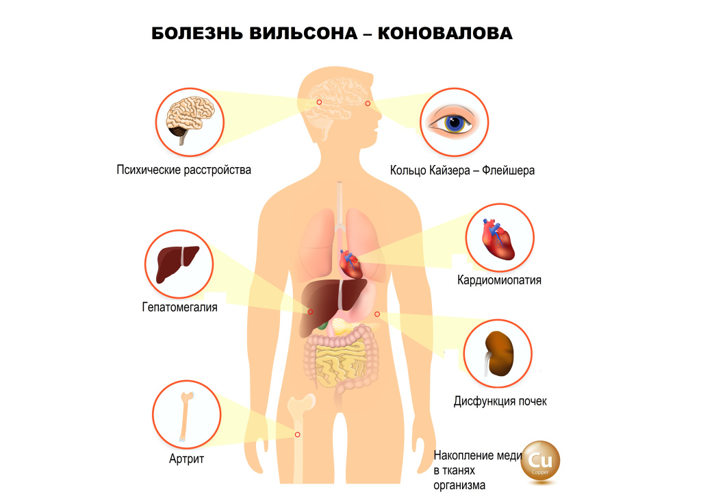 Вильсон-Коновалов.jpg