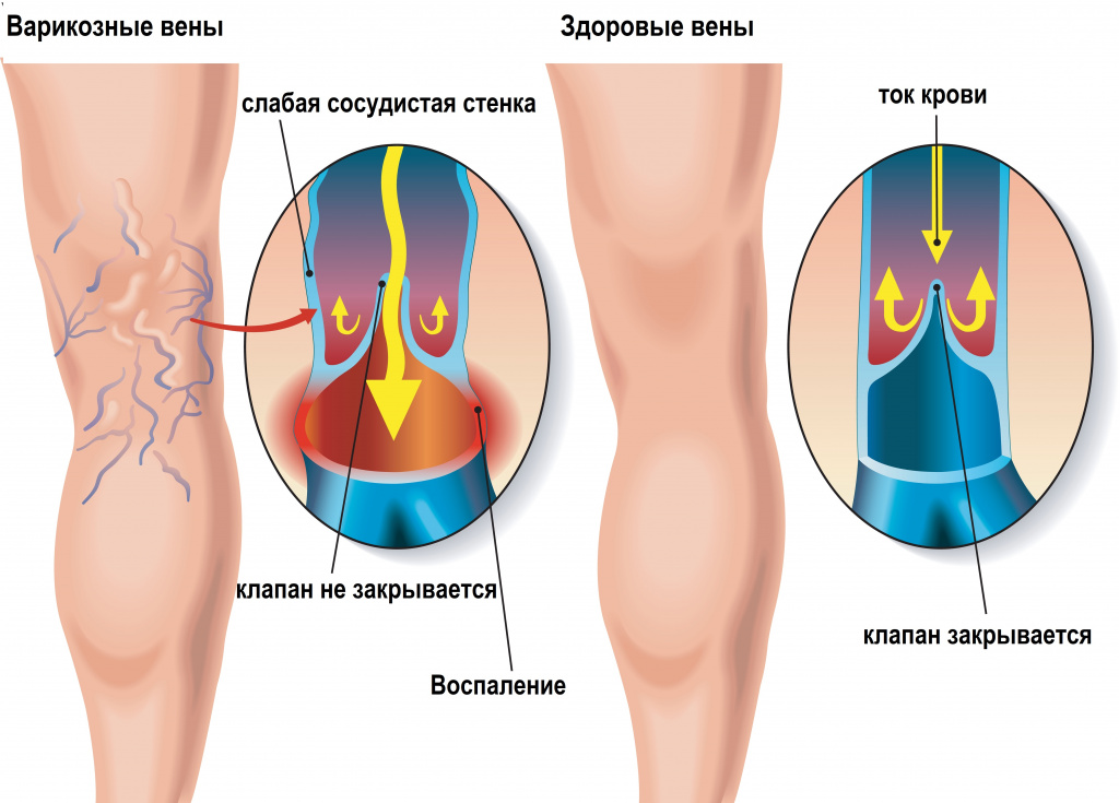 Клапан.jpg