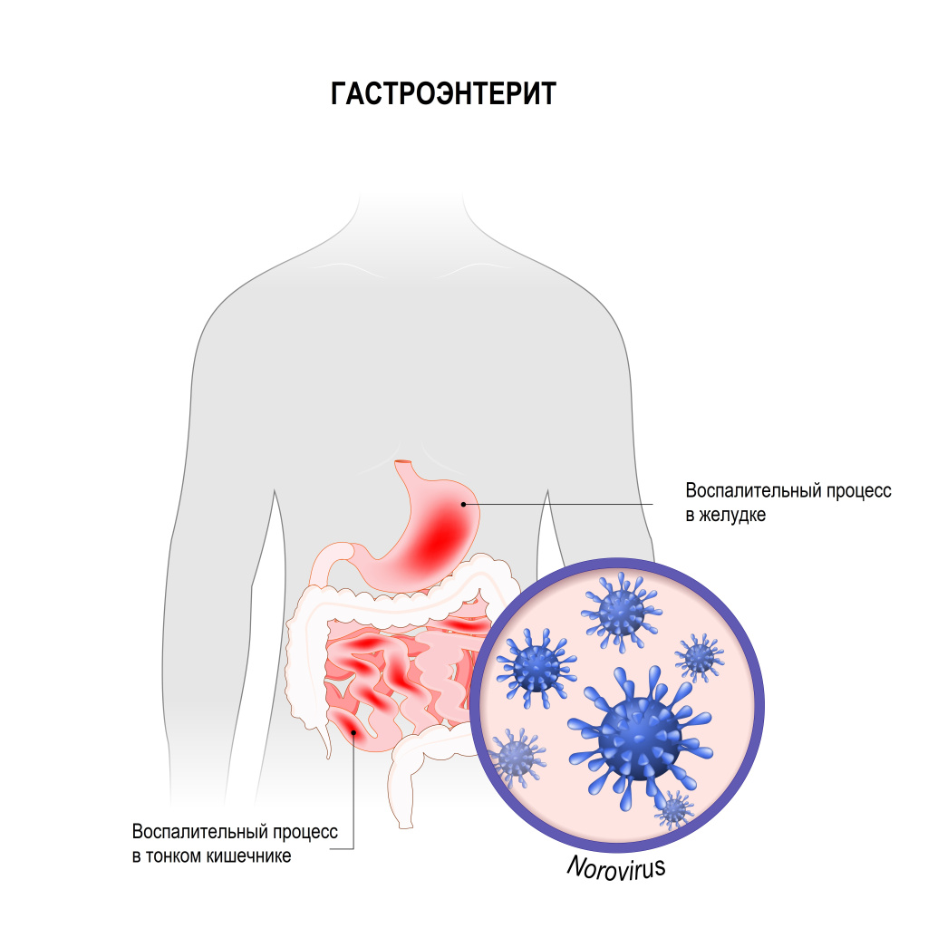 Норовирус.jpg