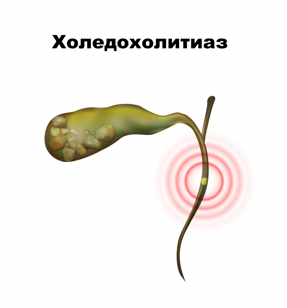 Желчь.jpg Желчь.jpg