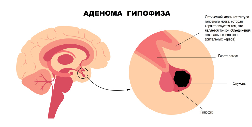 Гипофиз.jpg