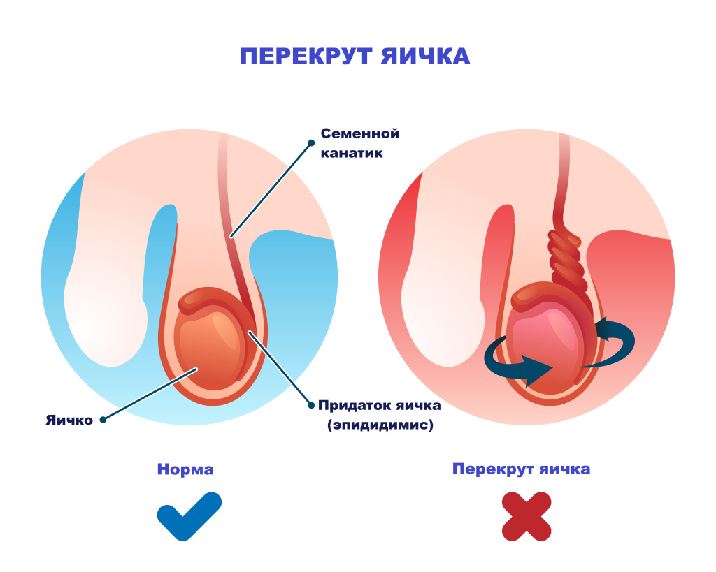 осмотр мужских яичек женщинами 