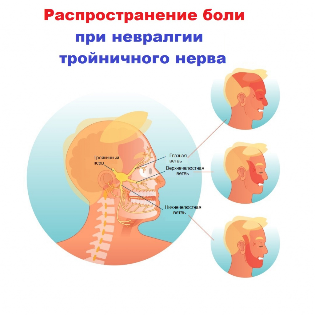 Застужен лицевой нерв народные средства лечения thumbnail