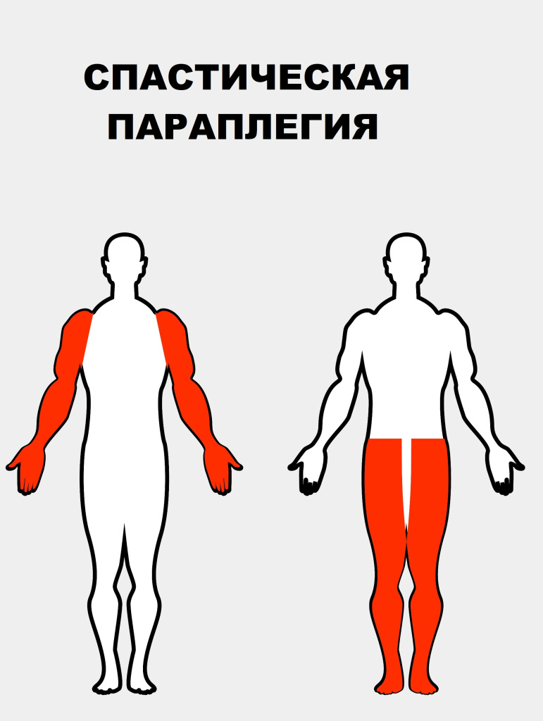 Руки_Ноги.jpg