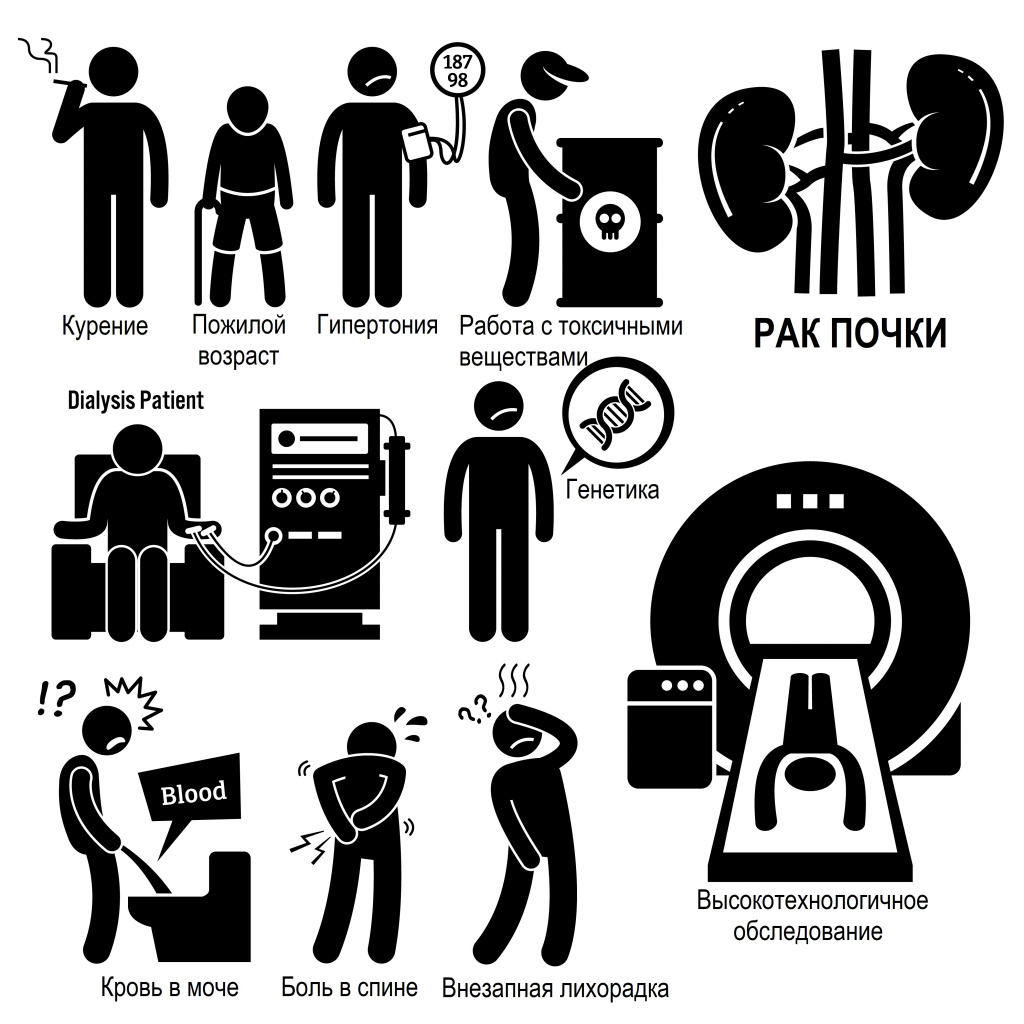 Онкология почки.jpg