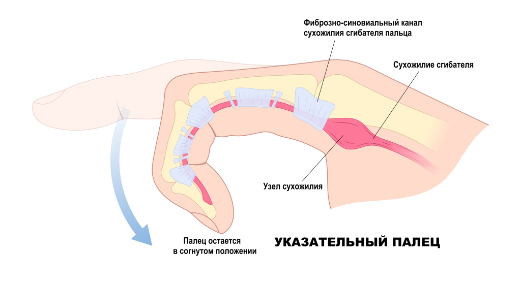 Указательный палец.jpg