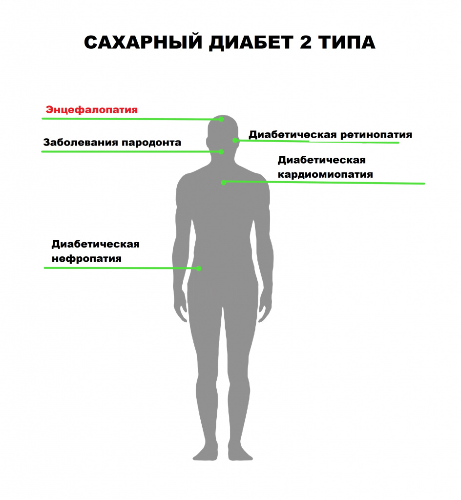 Лечение посттравматической энцефалопатии (без арахноидита) в санаториях Санкт-Петербурга