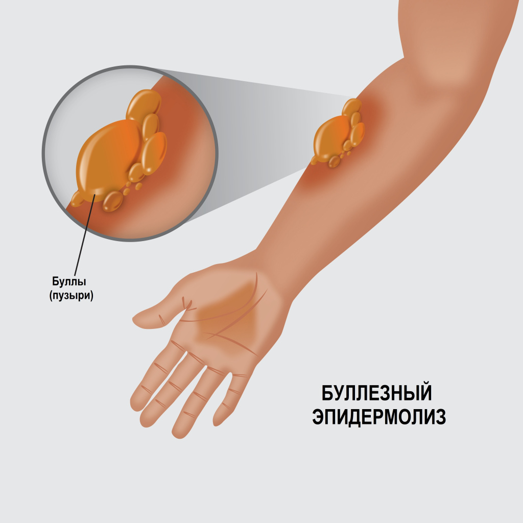 Буллы.jpg