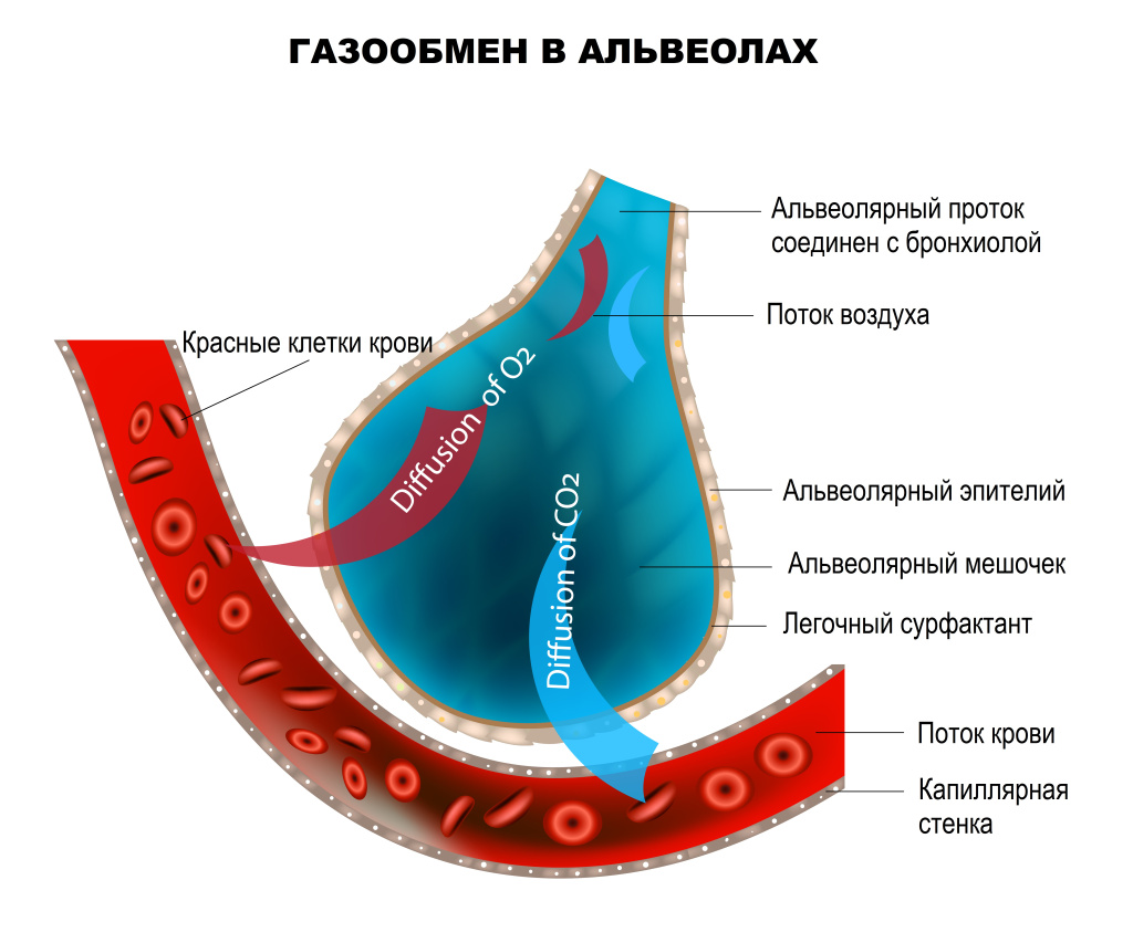 Пневмония.jpg