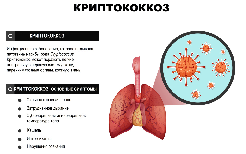 Криптококкоз.jpg