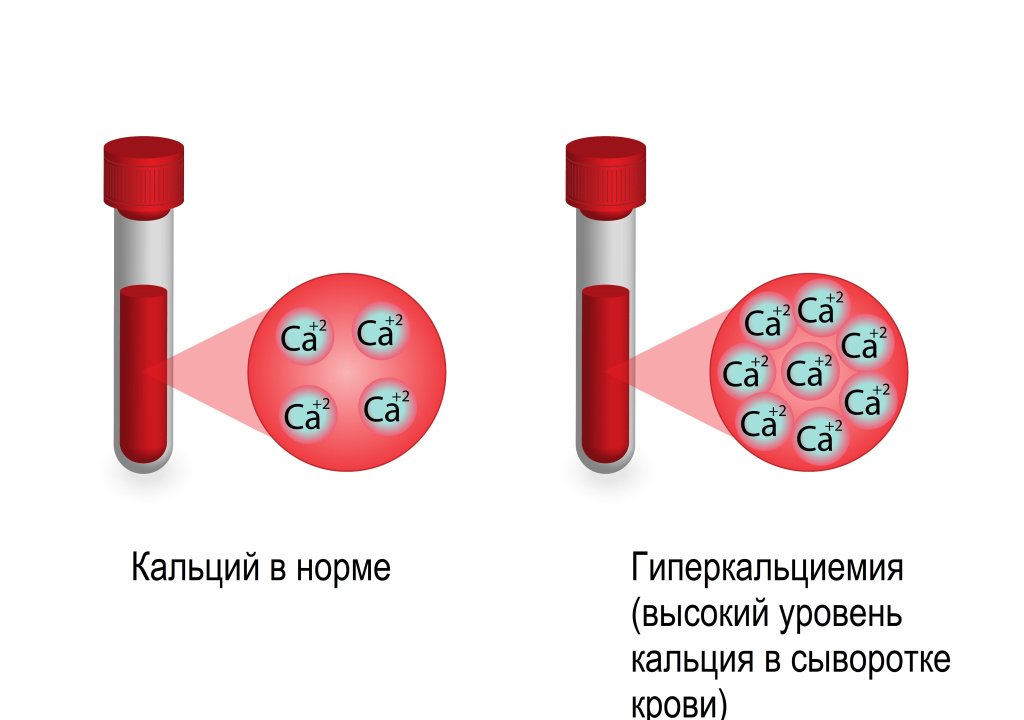Почки.jpg