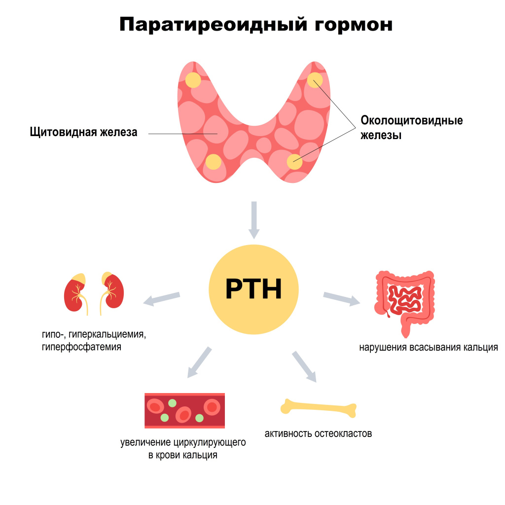 Гипопаратиреоз симптомы