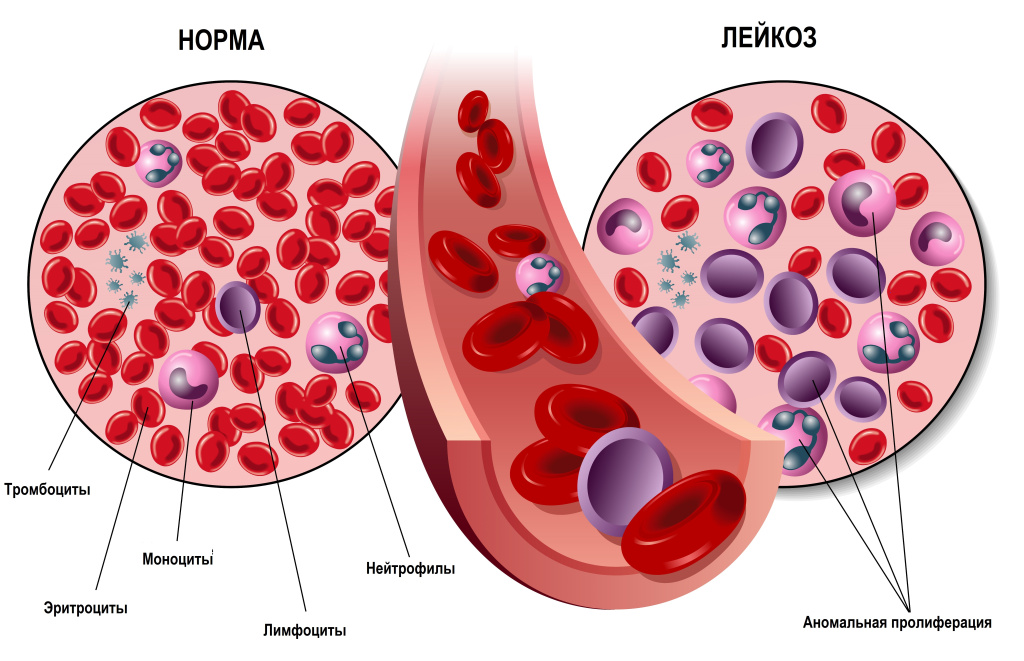 Кровь.jpg
