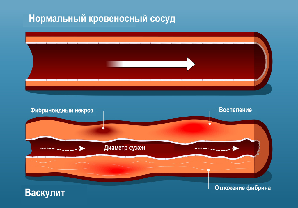 Сосуд Такаясу.jpg