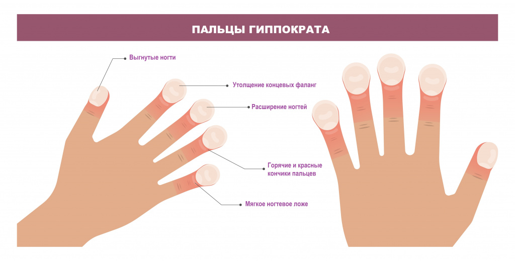 Пальцы.jpg Пальцы.jpg