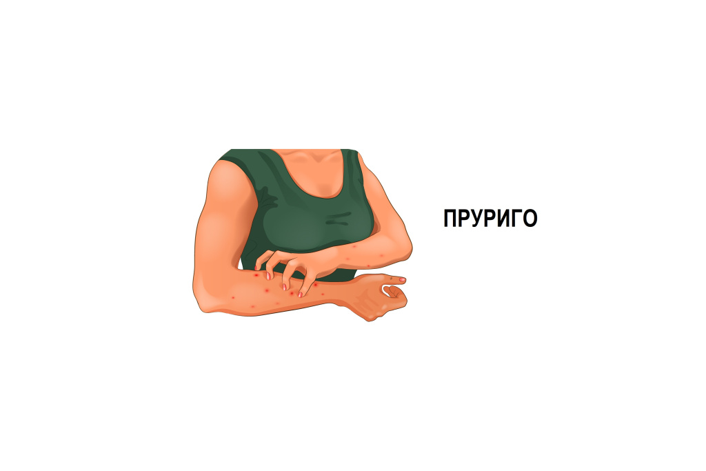 Почесуха.jpg