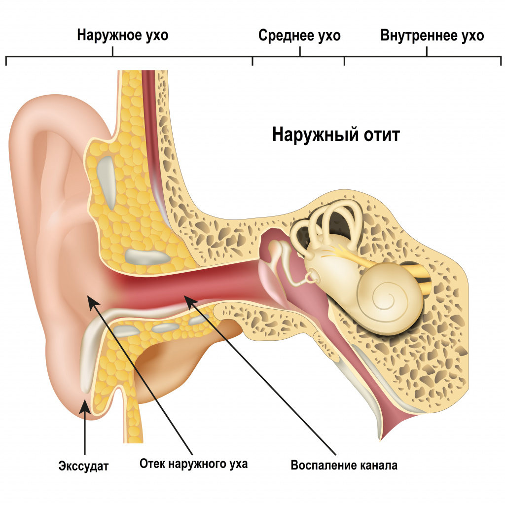 Причины сухости серы в ушах: как избавиться от дискомфорта