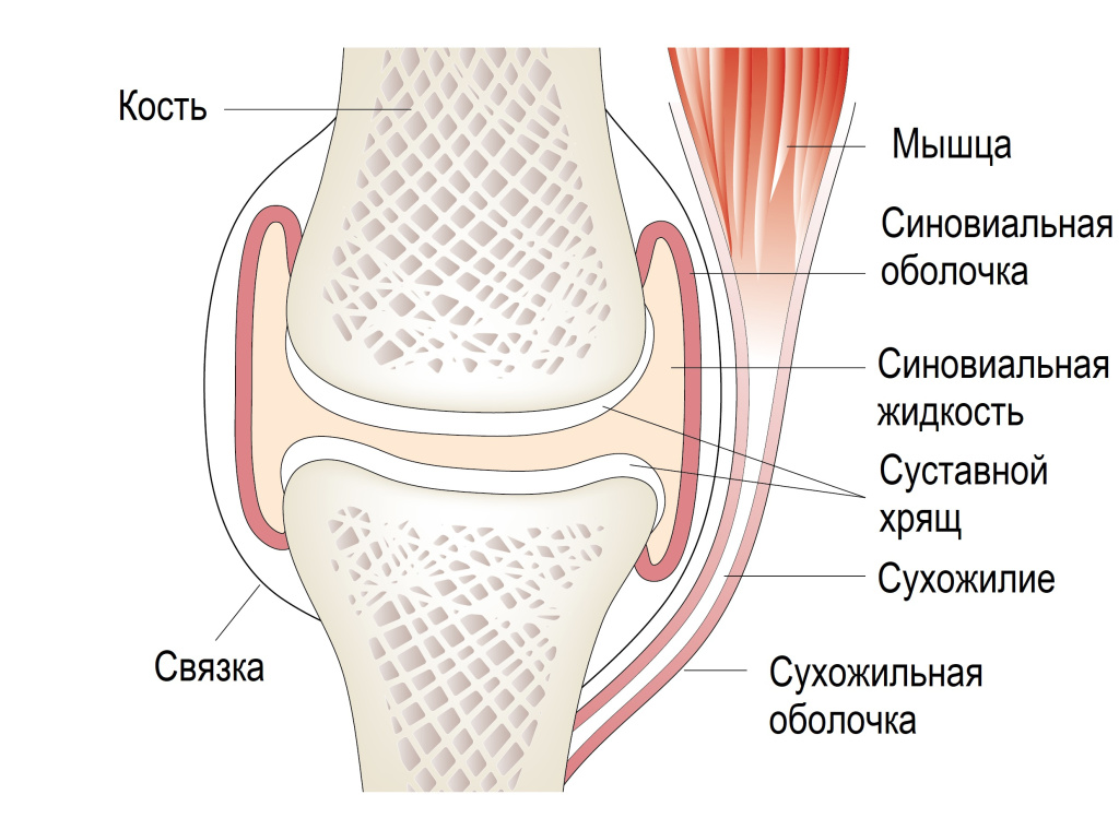 Внесуставной ревматизм.jpg
