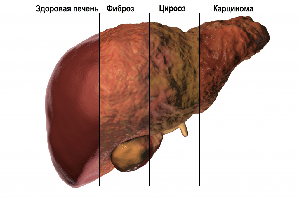 Gdje liječe adenom prostate u regiji Poltave