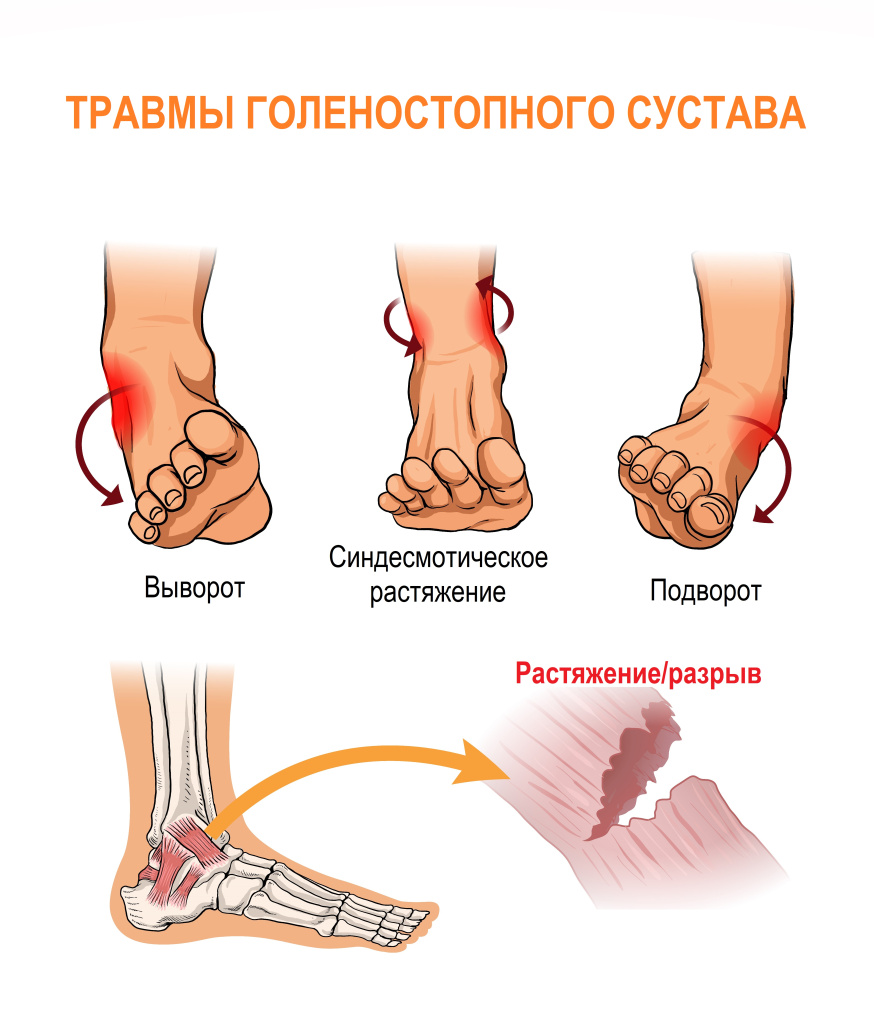 Связка.jpg