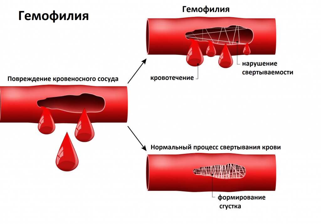 анализы на свертываемость крови список