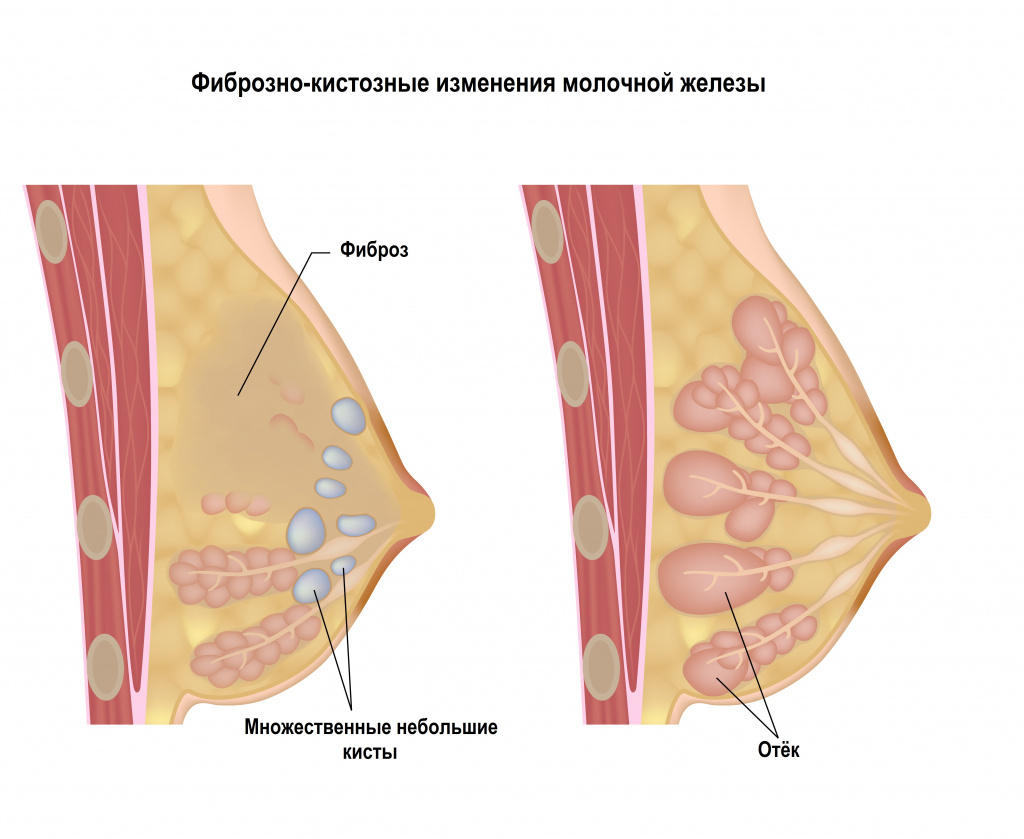 Молочные железы.jpg Молочные железы.jpg