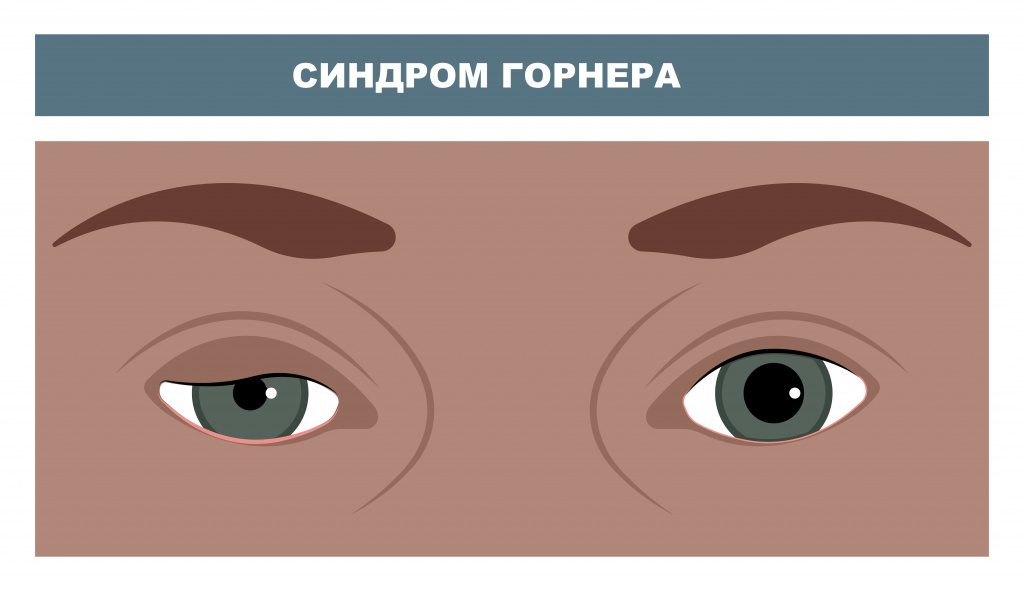 Два глаза.jpg