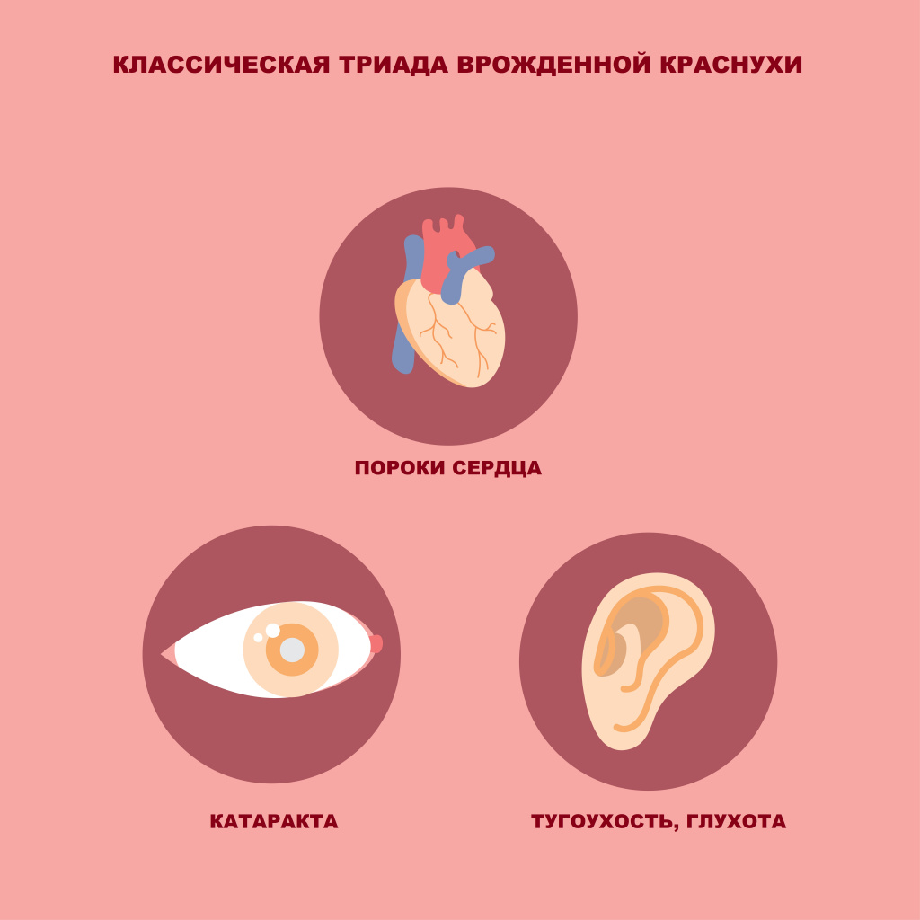 Врожденная краснуха.jpg