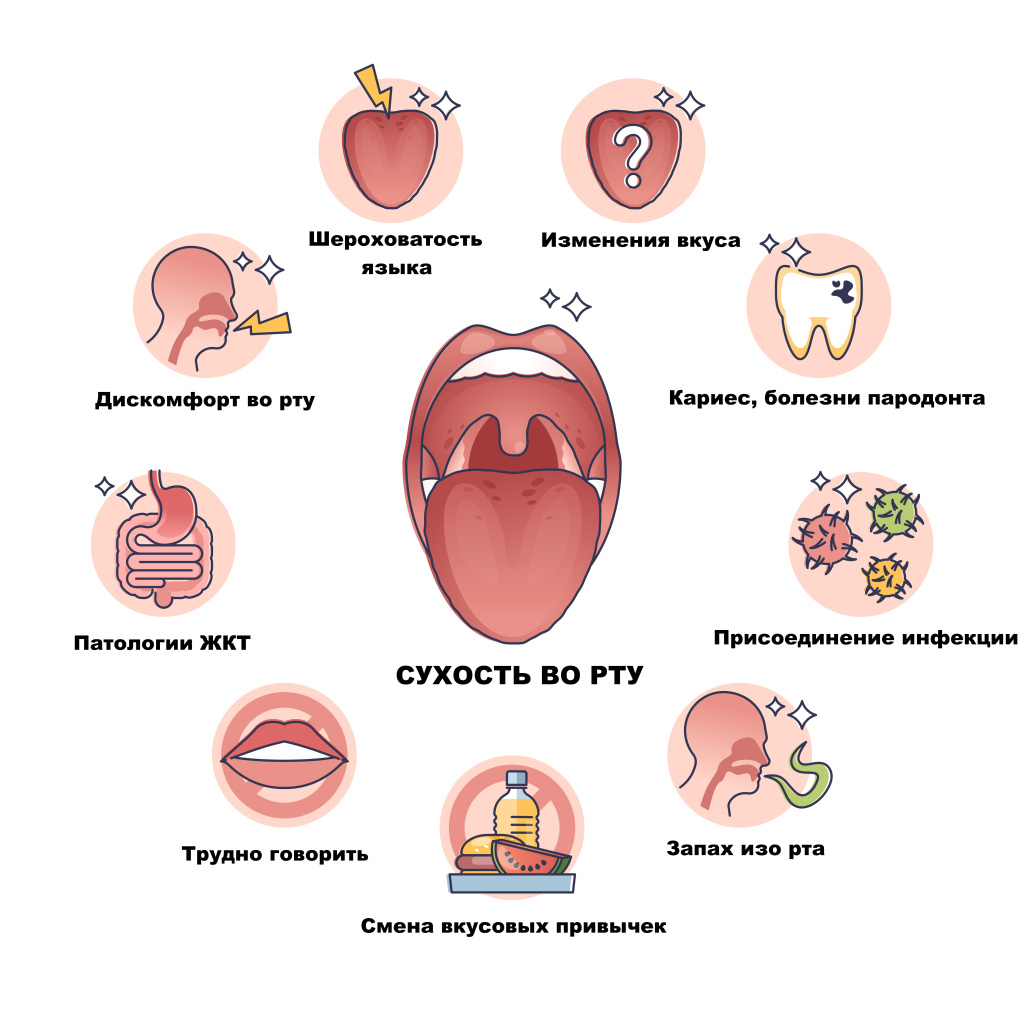 Сухость во рту.jpg