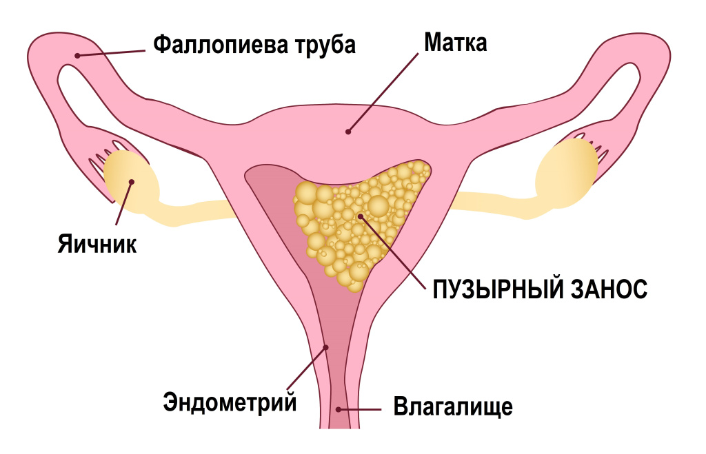 Занос.jpg
