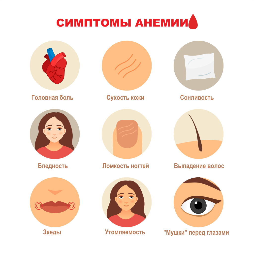 Анемия после родов.jpg