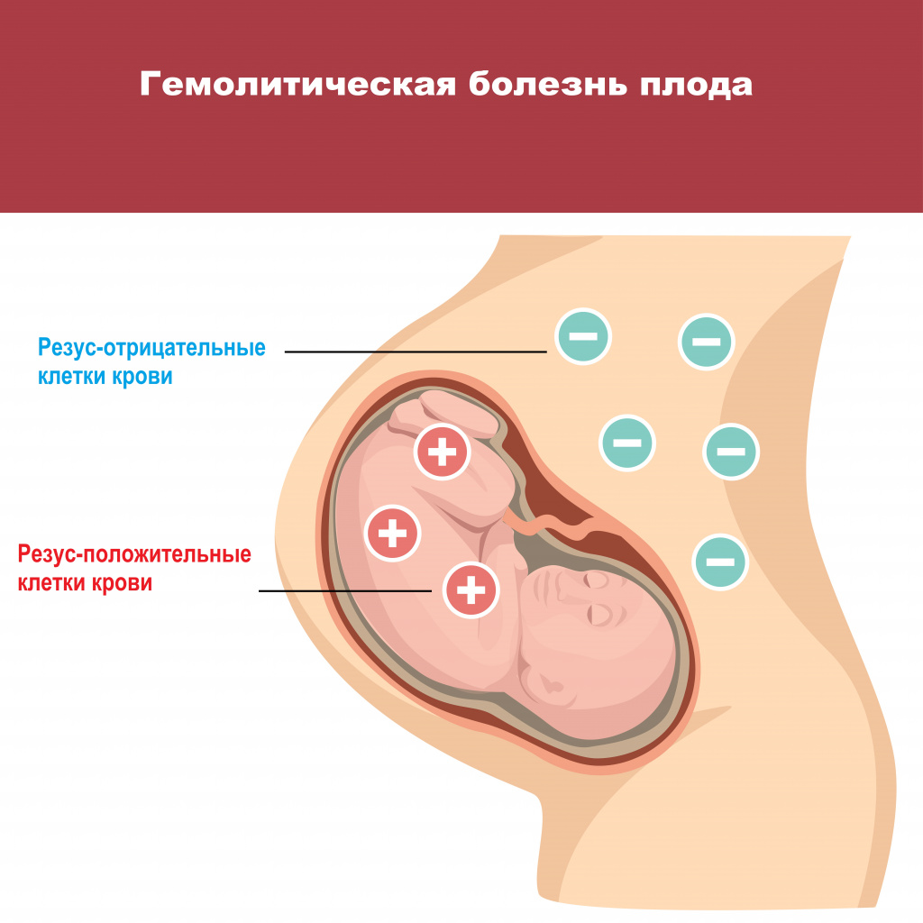 Болезнь.jpg