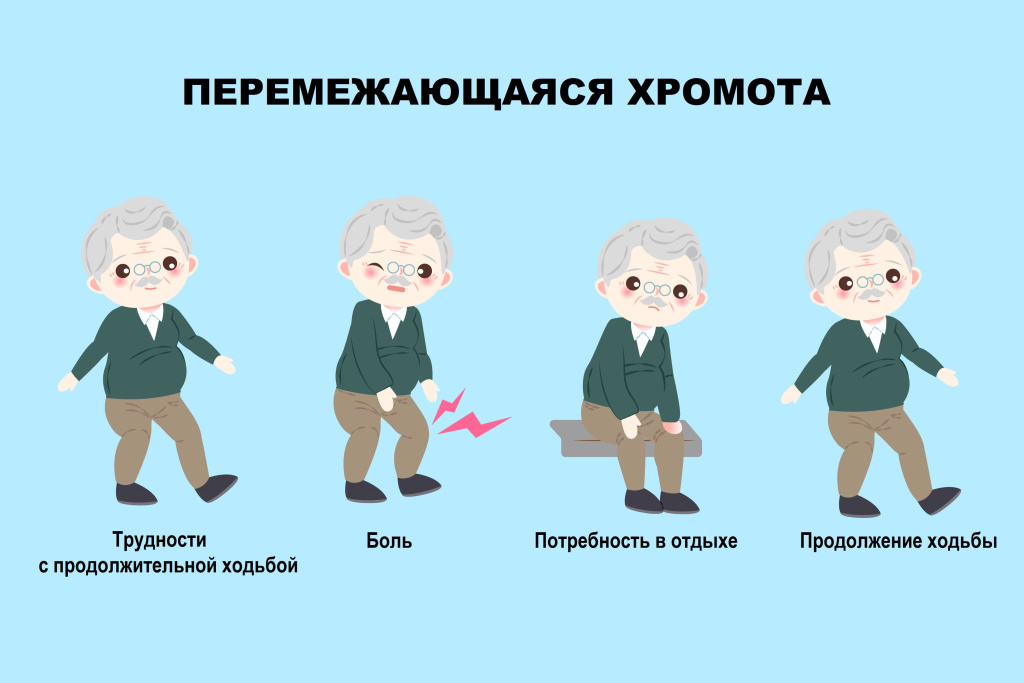 Хромота.jpg