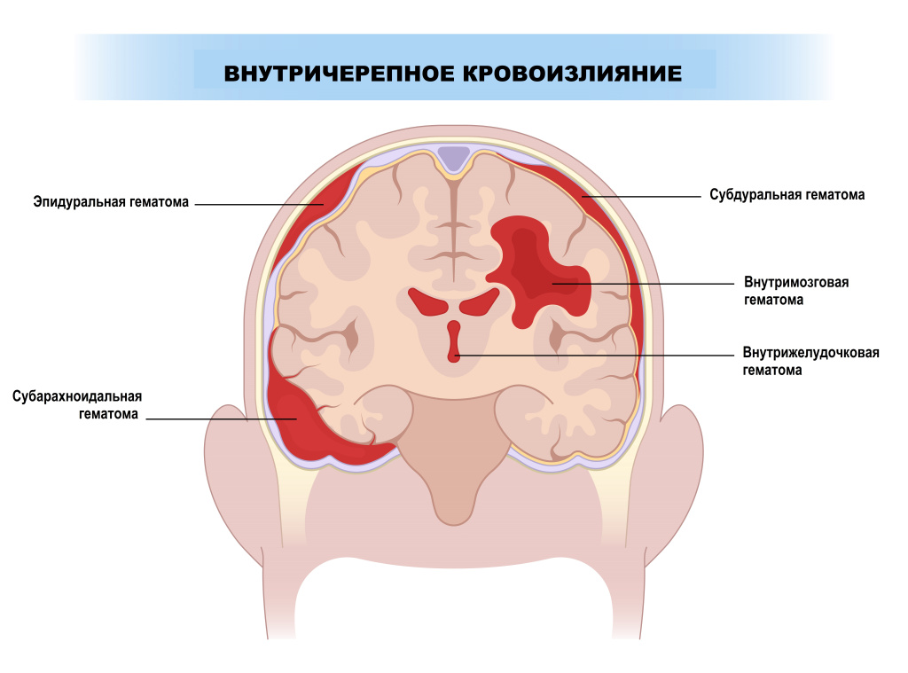 Мозг.jpg