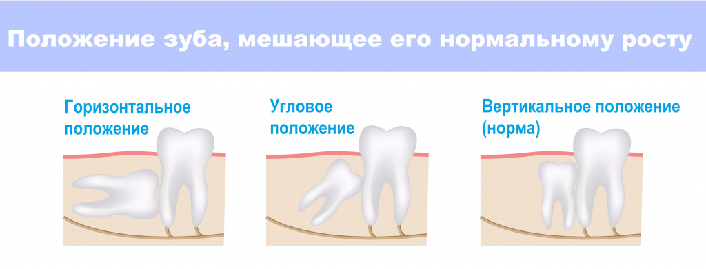 Положение.jpg Положение.jpg