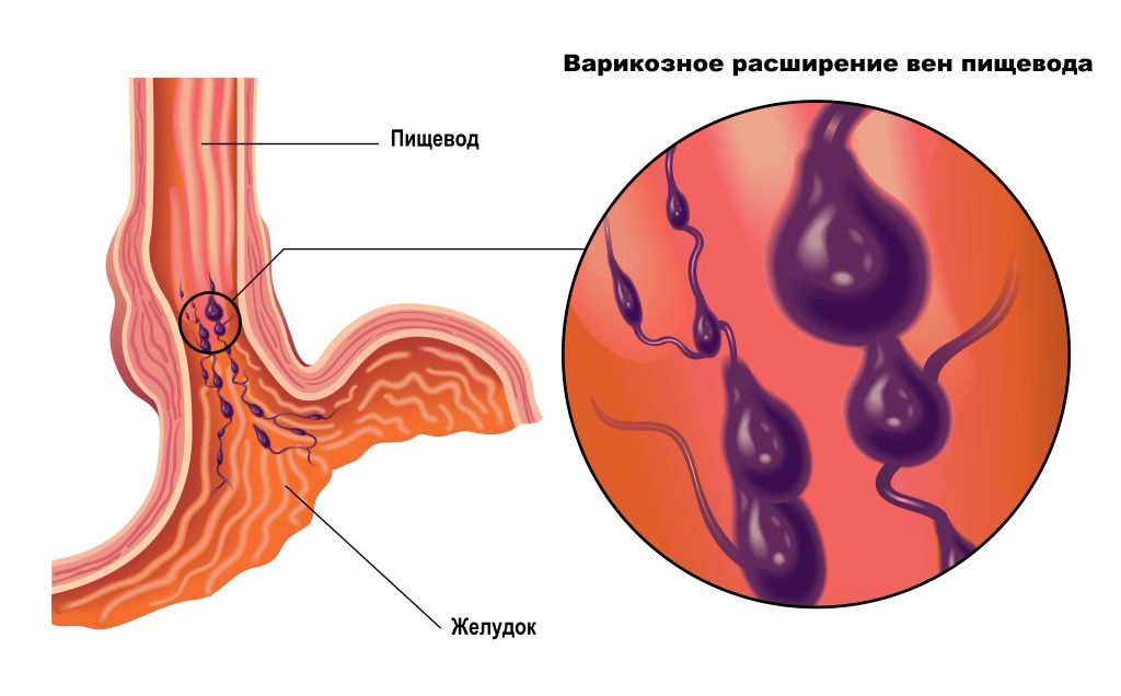 Пищевод.jpg
