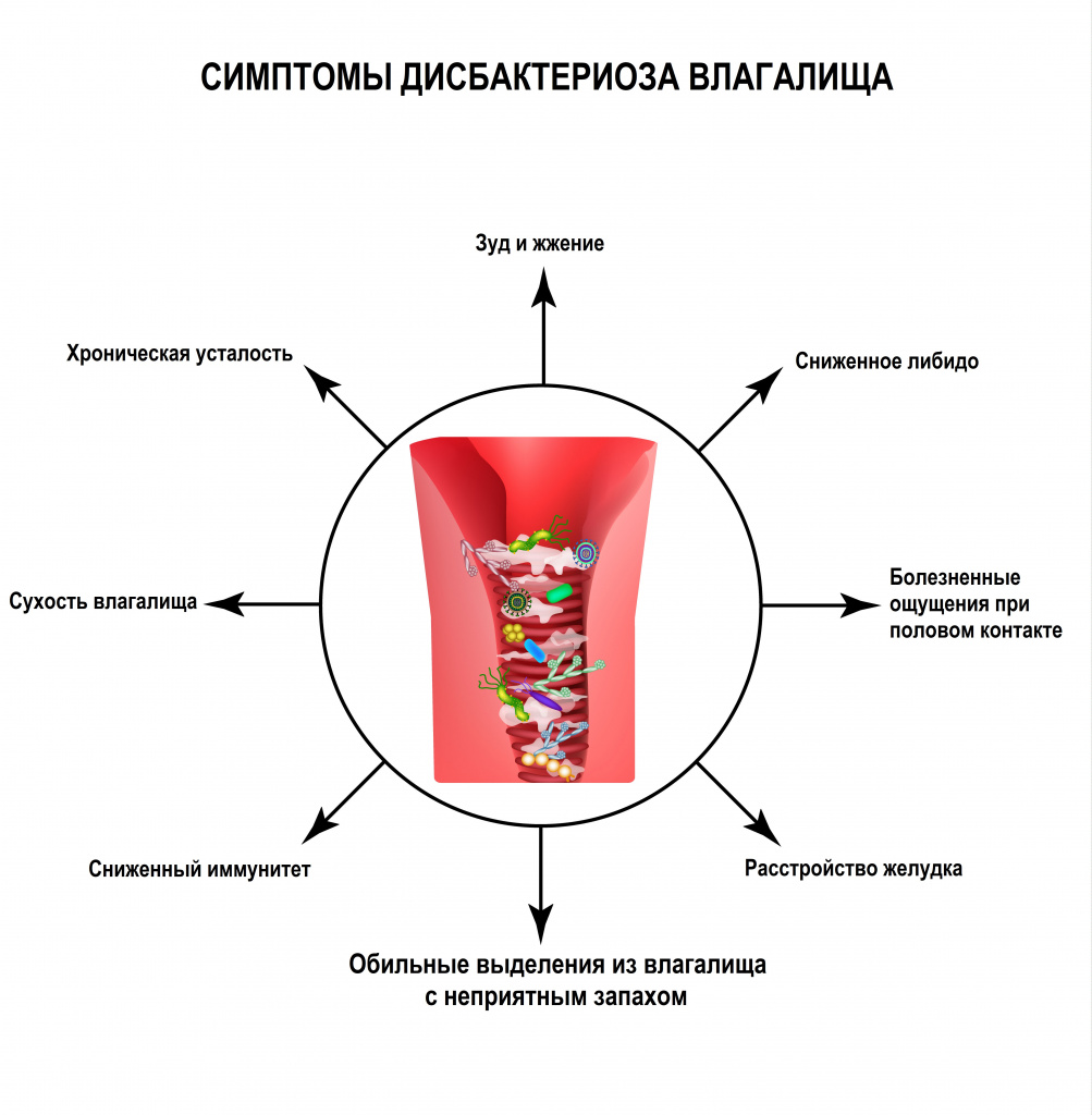 aspekt liječenje artroza