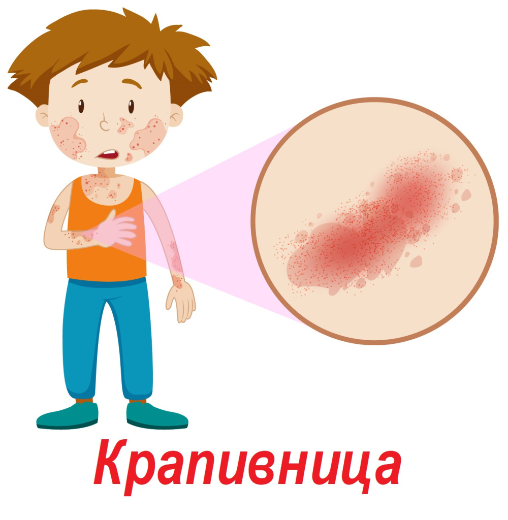 Крапивница.jpg