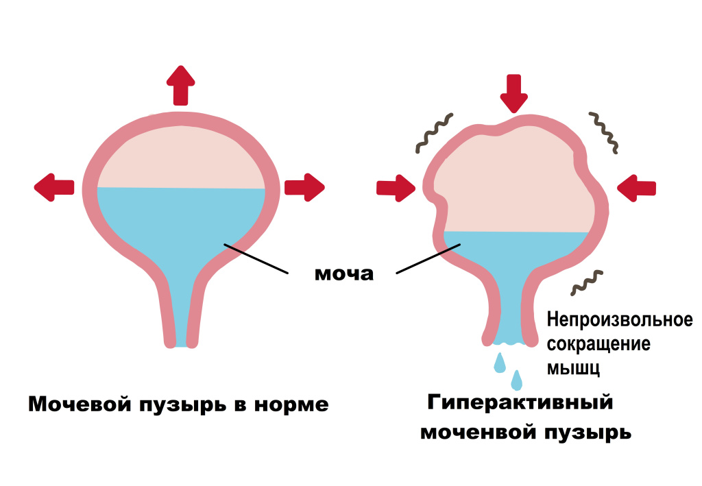 Пузырь.jpg