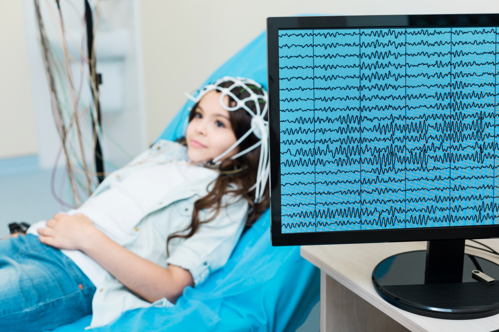Электроэнцефалографии для дифференциальной диагностики эпилепсии.jpg