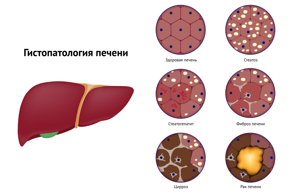 Печень.jpg