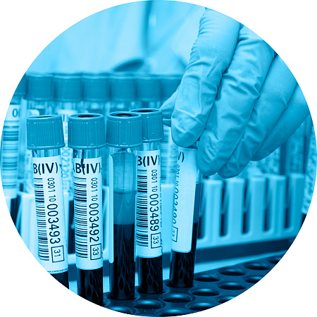  Количественный тест на антитела к коронавирусу <br>SARS-CoV-2  - Фото 1